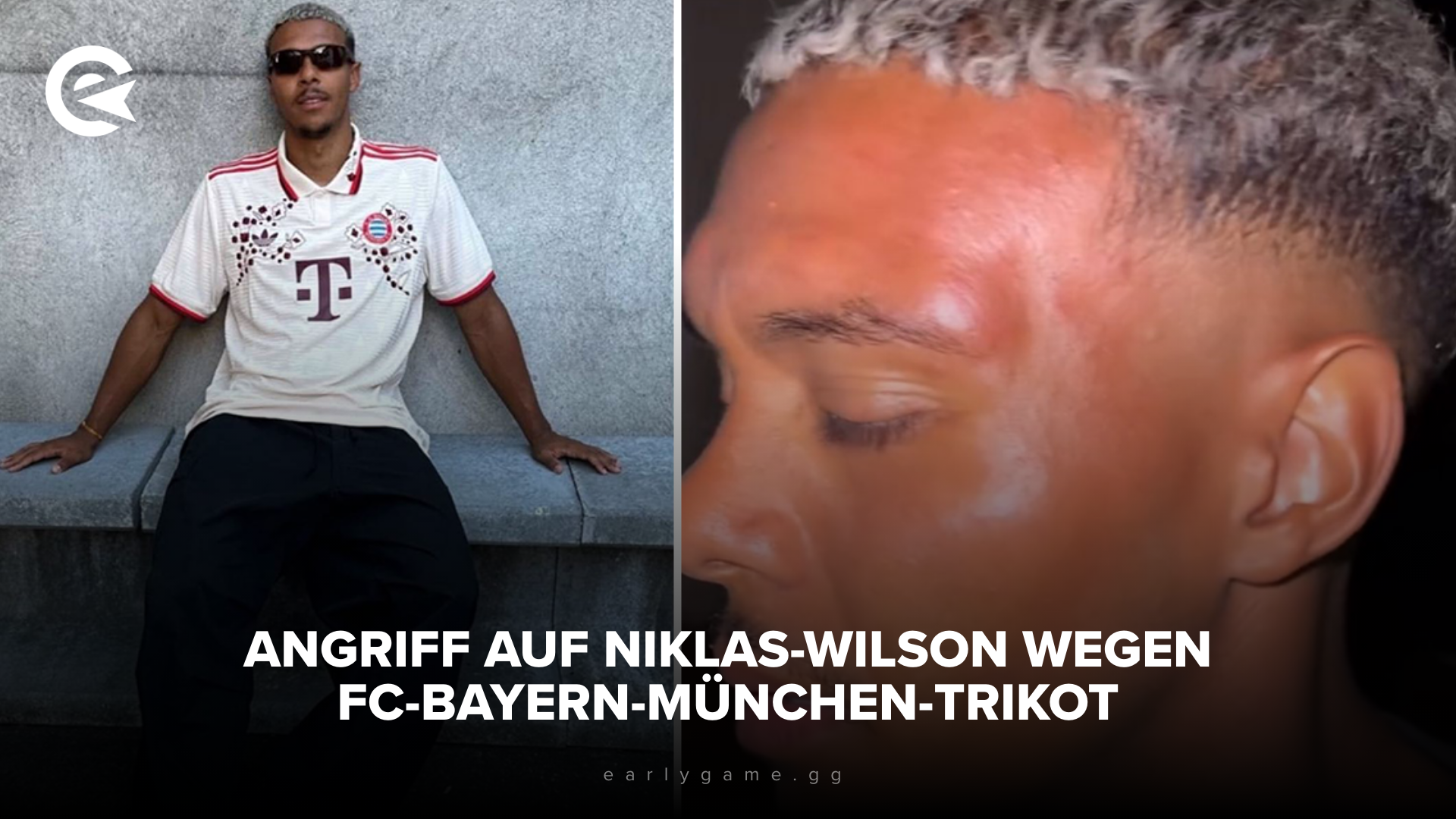 Angriff auf Niklas Wilson wegen FC Bayern München Trikot