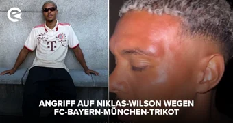 Angriff auf Niklas Wilson wegen FC Bayern München Trikot