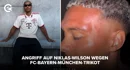 Angriff auf Niklas Wilson wegen FC Bayern München Trikot