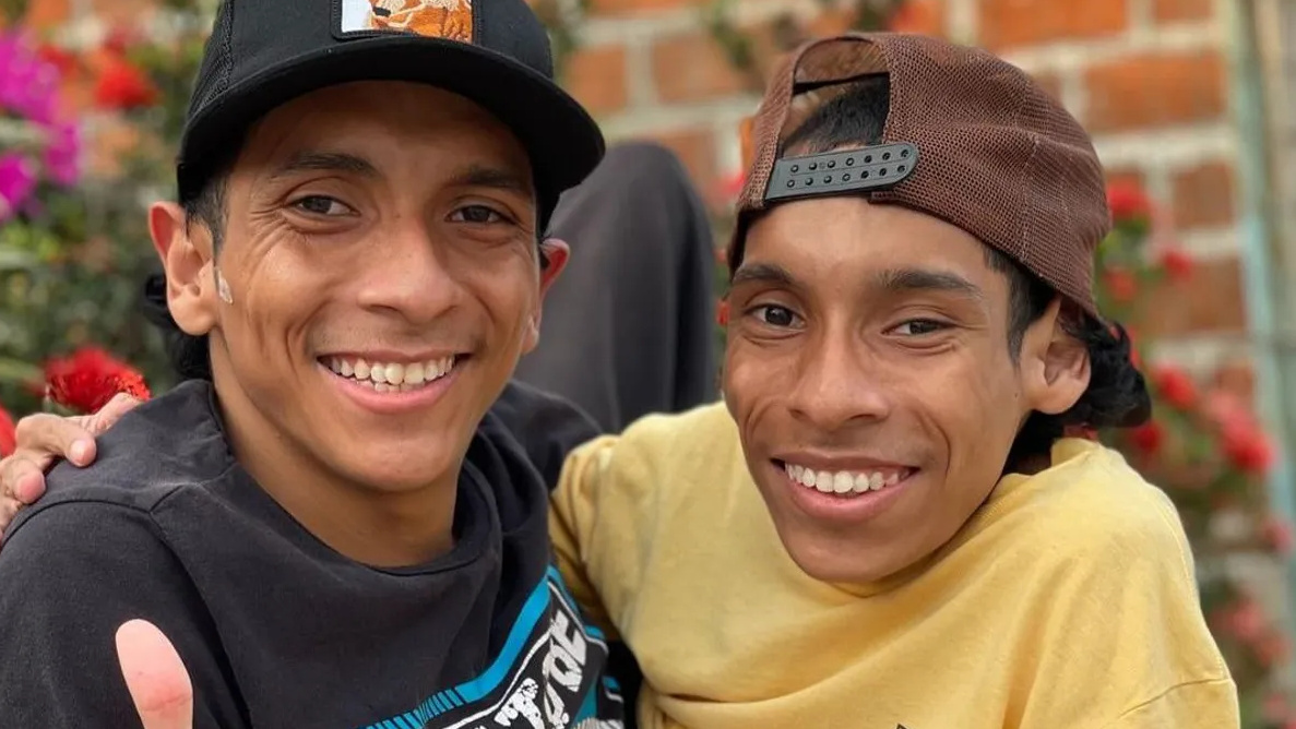 Conjoined twin influencers 1