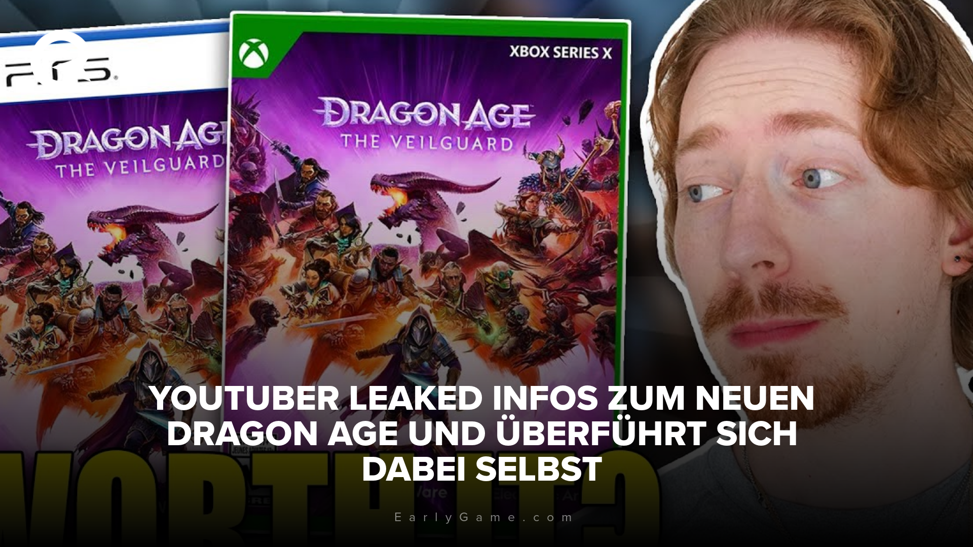 Matty Plays leaked Dragon Age
