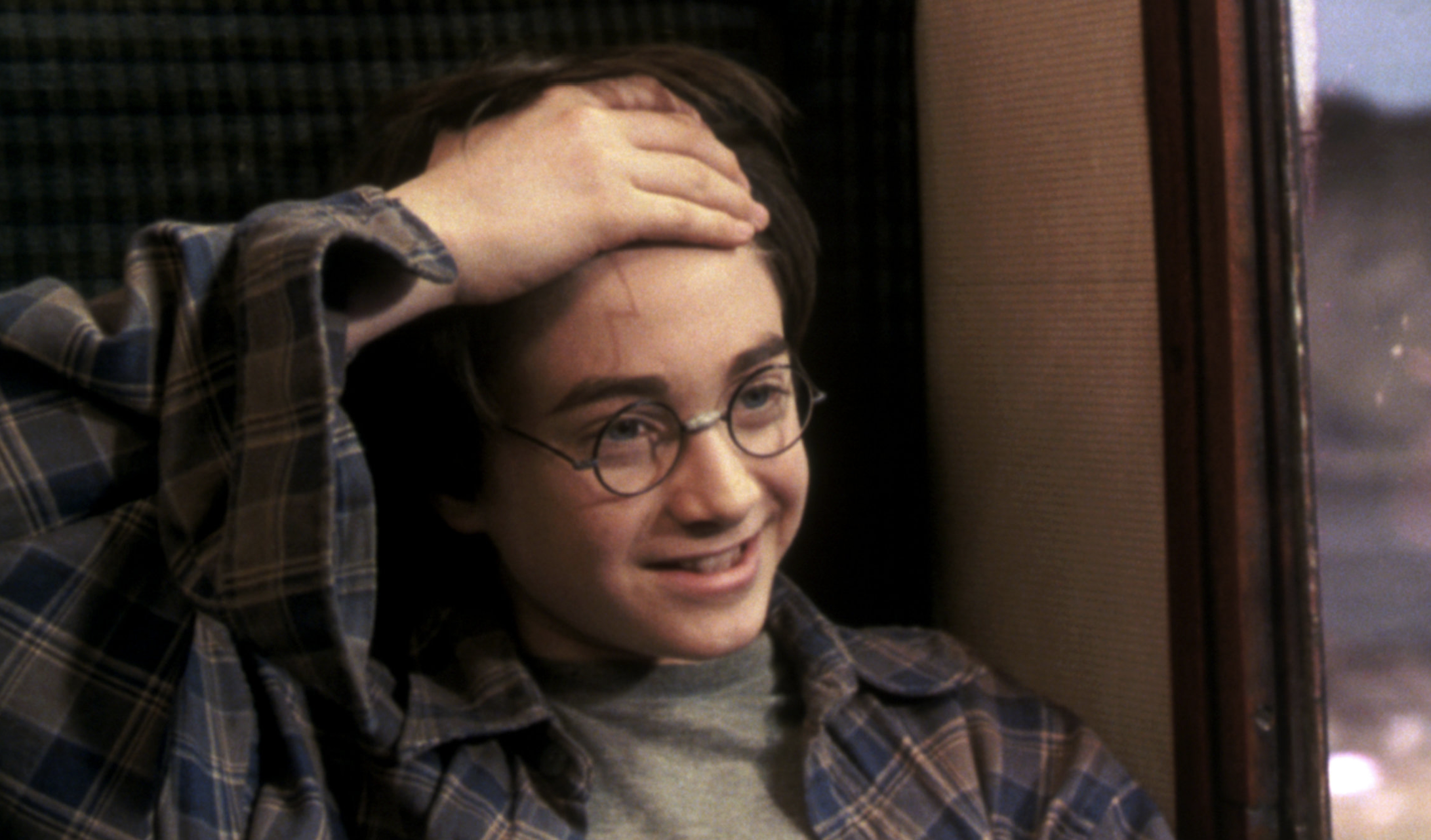 Scar on Harrys head