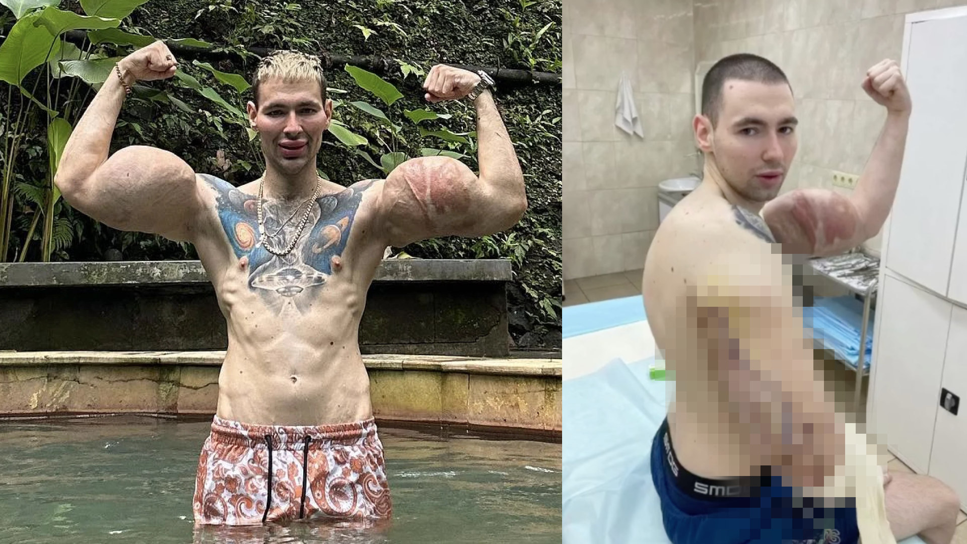 Tik Tik Body Builder Arme