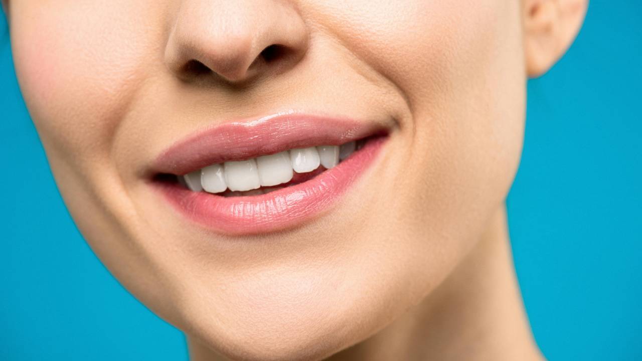Woman Arrested For Using Superglue To Apply Fake Dental Veneers In Florida