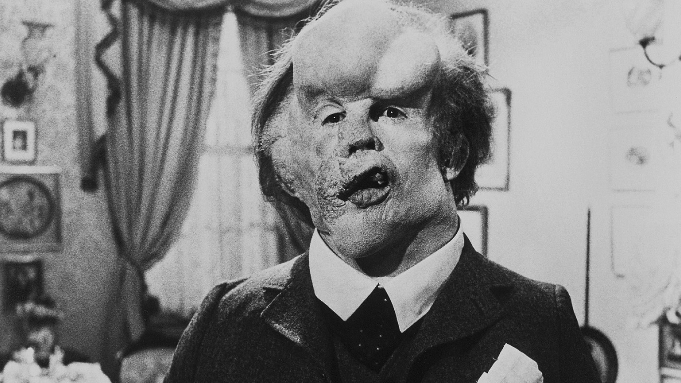 Cropped John Hurt The Elephant Man